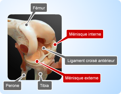 Arthroscopie du genou